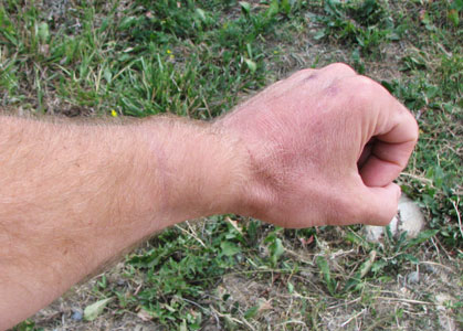 picture of my wrist